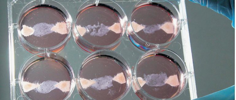 Could Lab Meat Be The Answer?